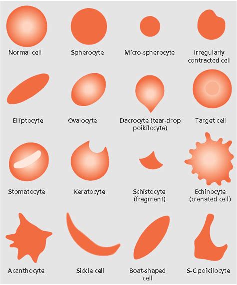 Poikilocytosis: Abnormal Shaped Blood Cells .